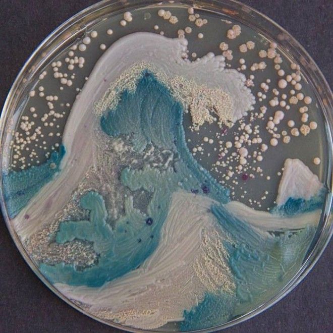 Большая волна Кандиды работа Кристины Маркос Candida albicans Candida glabrata Candida parapsilosis бактерия картина микробиолог