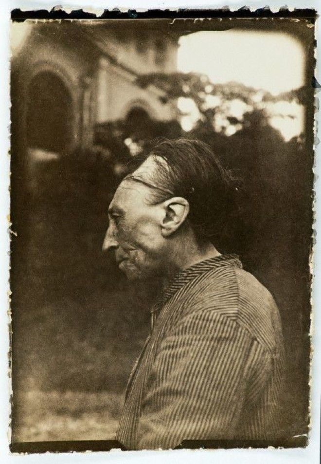 Умышленная модификация черепа, также известная как «тулузская деформация». | Фото: commons.wikimedia.org. Умышленная модификация черепа также известная как тулузская деформация Фото commonswikimediaorg