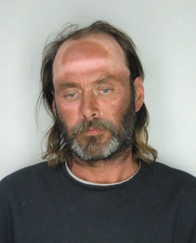 Как не стоит загорать 23 фото