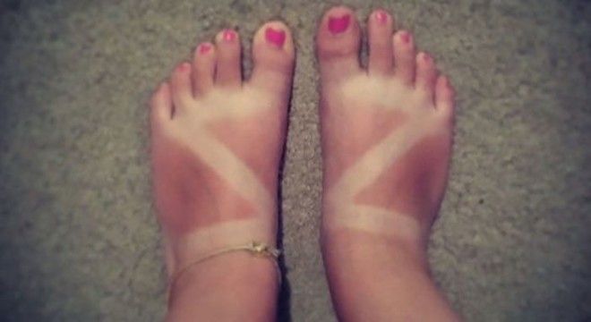 Как не стоит загорать 23 фото