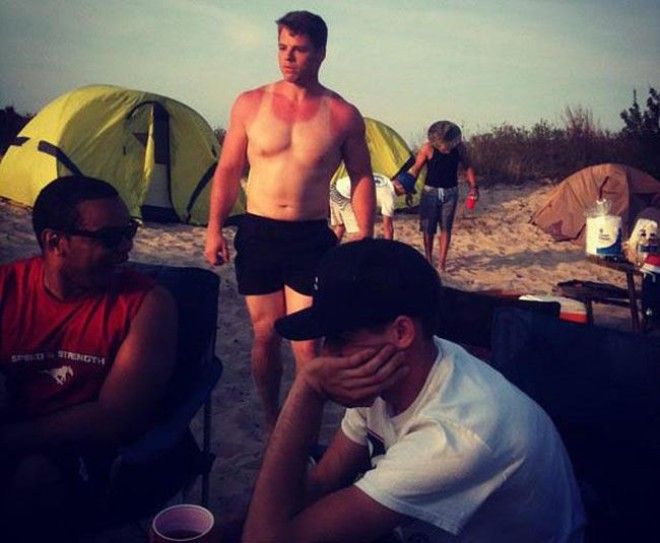 Как не стоит загорать 23 фото