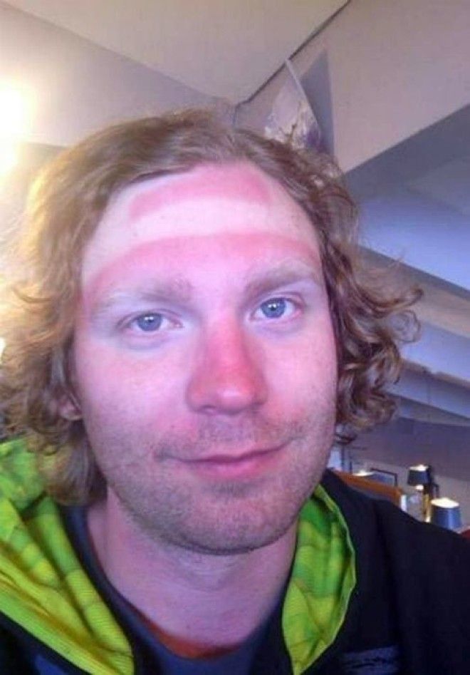 Как не стоит загорать 23 фото