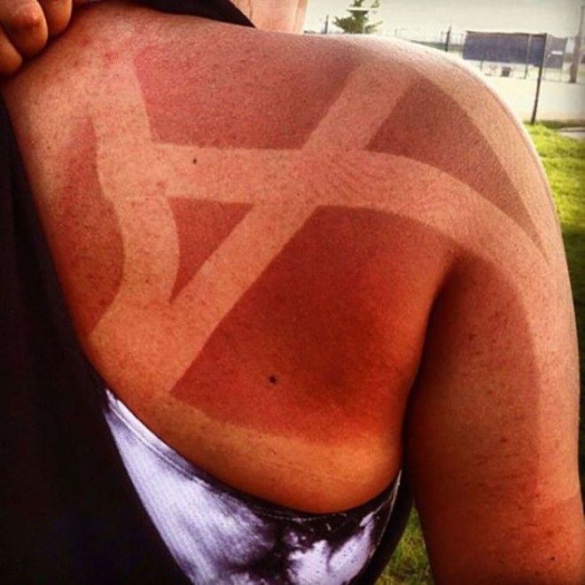 Как не стоит загорать 23 фото