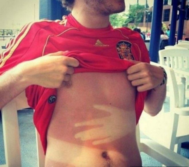 Как не стоит загорать 23 фото