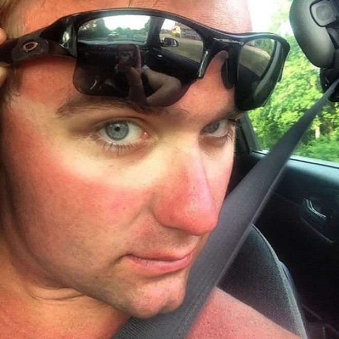 Как не стоит загорать 23 фото