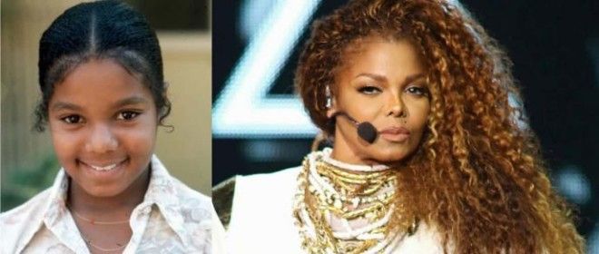 Топ8 знаменитостей которые легли под нож хирурга в слишком юном возрасте