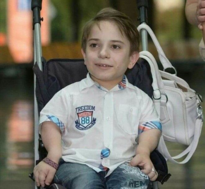 10 знаменитостей с ограниченными возможностями которые учат не сдаваться