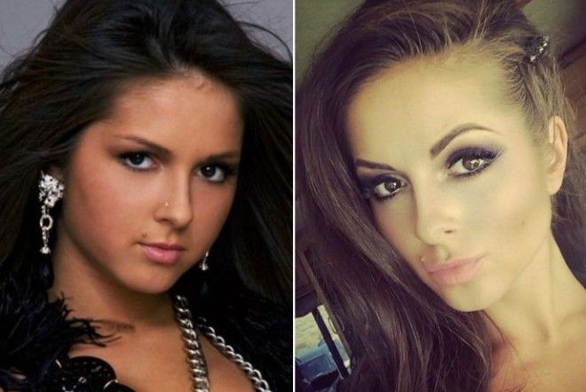 10 знаменитостей которым пластика явно пошла на пользу