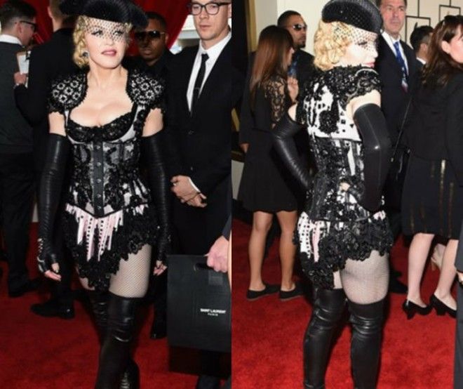 10 звезд которые заработались настолько что забыли надеть юбку