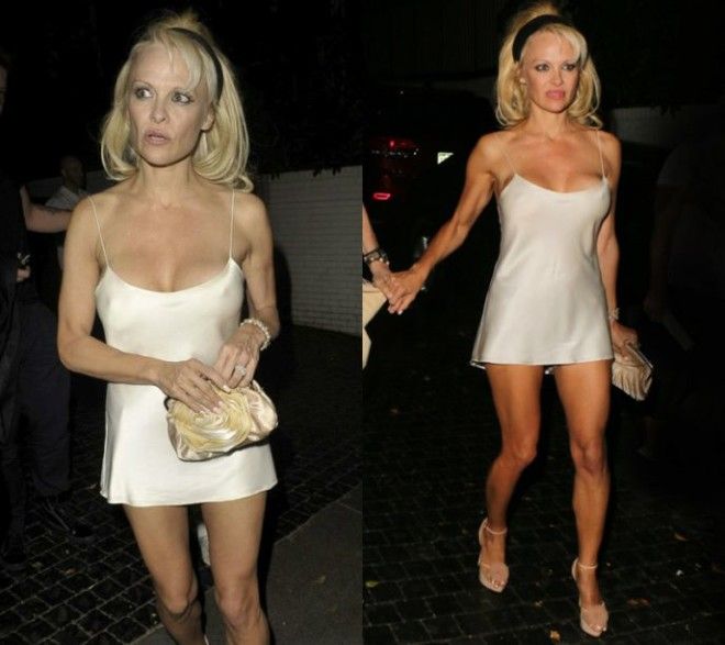 10 звезд которые заработались настолько что забыли надеть юбку